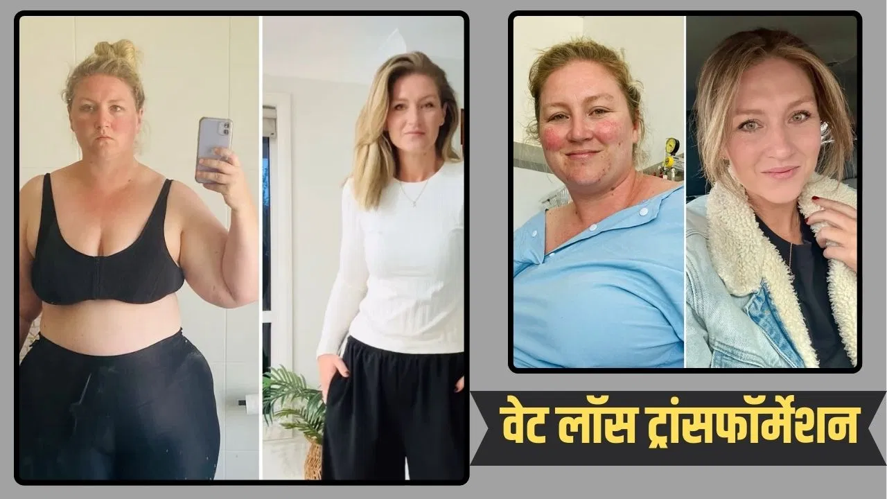Weight Loss Transformation: महिला ने कुछ ही महीनों में घटा लिया 70kg वजन, बताई 5 जरूरी बातें